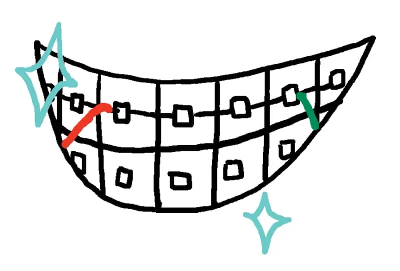 ImageThink graphic recording, illustration of smiling mouth with braces on teeth.